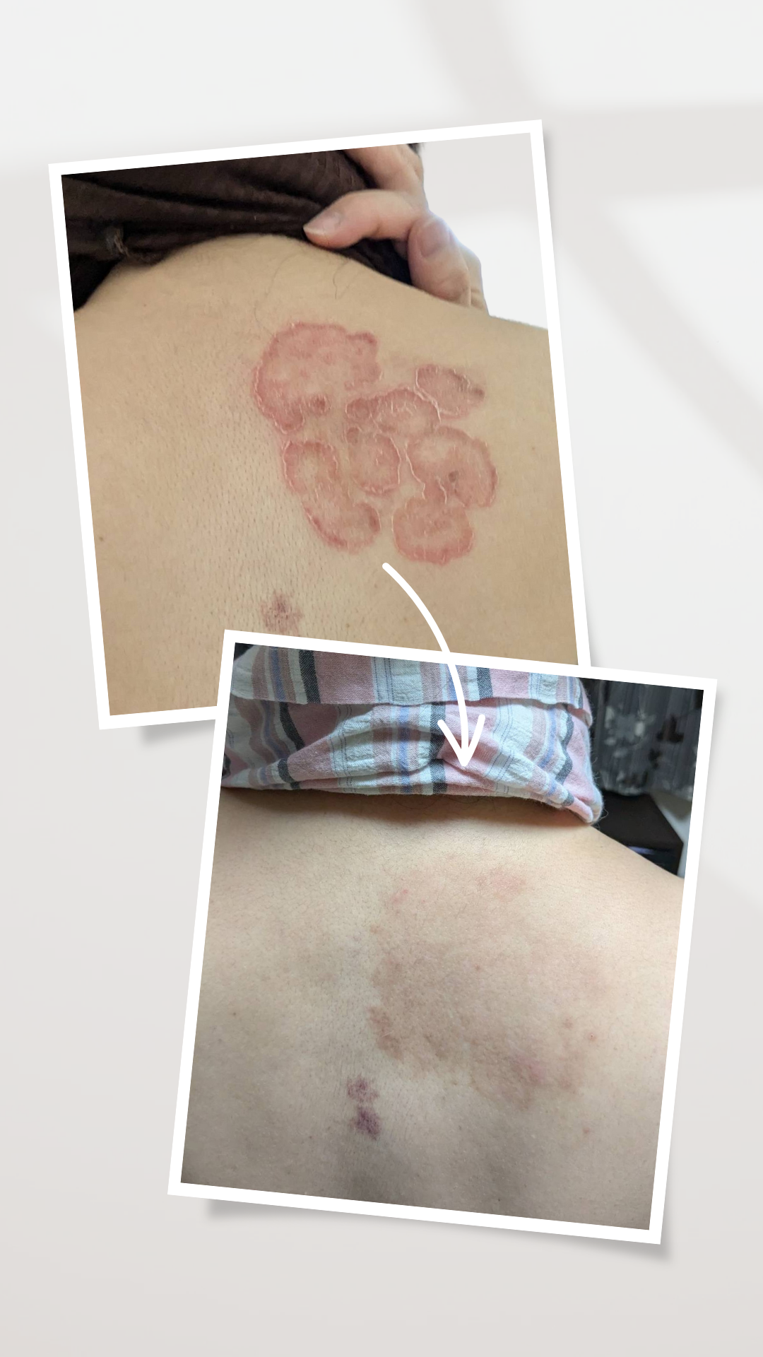 ヒトデ石鹸喜びの体験談